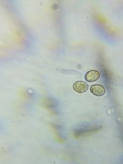 Cortinarius causticus