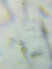 Cortinarius causticus