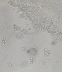 Amparoina spinosissima image