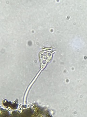 Vorticella