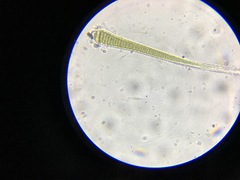 Calothrix