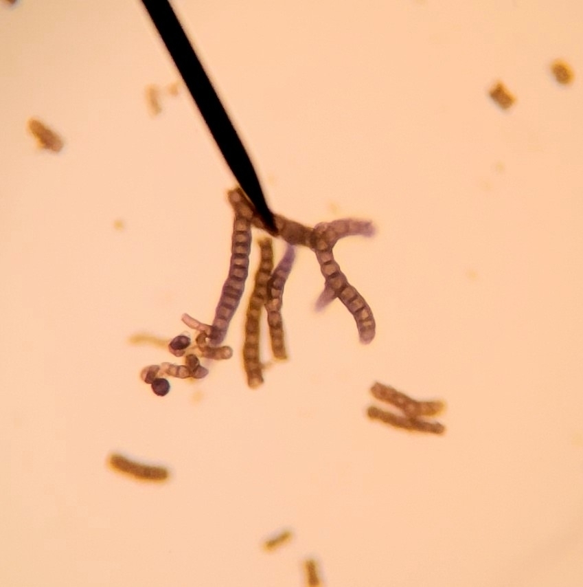 Heteroconium glutinosum