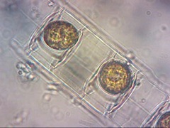 Lithodesmium