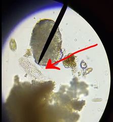 Gastrotricha