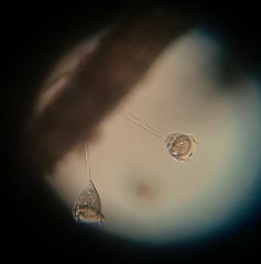 Vorticella campanula