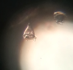 Vorticella campanula