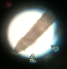 Vorticella campanula