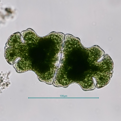 Euastrum oblongum var. cephalophorum
