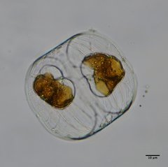Foraminifera