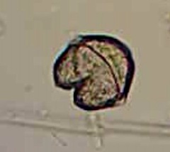Protoperidinium