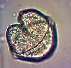 Protoperidinium