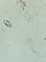 Hydrodictyaceae