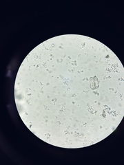 Euglypha