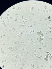 Euglypha