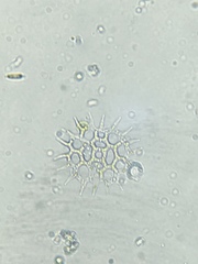Pediastrum