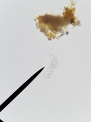 Gastrotricha