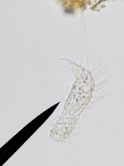 Gastrotricha