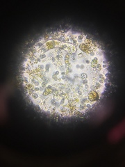 Gastrotricha