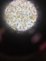 Gastrotricha