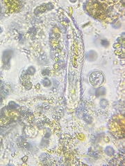 Gastrotricha