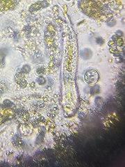 Gastrotricha
