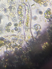 Gastrotricha