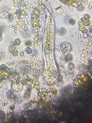 Gastrotricha