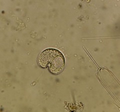 Protoperidinium