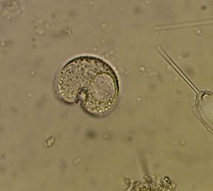 Protoperidinium