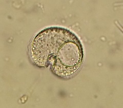 Protoperidinium