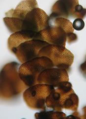 Frullania pentapleura