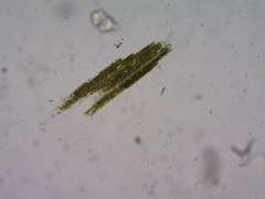 Aphanizomenon flosaquae
