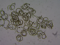 Dolichospermum