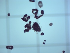 Dolichospermum lemmermannii