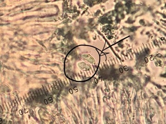 Lecidella carpathica