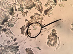 Lecidella carpathica