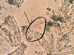 Lecidella carpathica