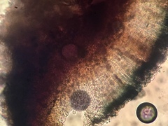 Lecidella carpathica