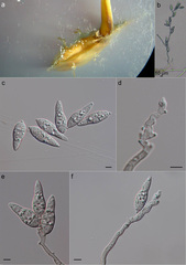 Brusone (Pyricularia oryzae)