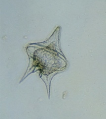 Protoperidinium