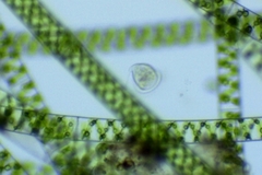 Vorticella