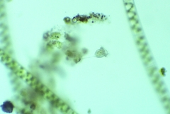Vorticella
