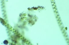 Vorticella