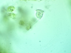 Vorticella