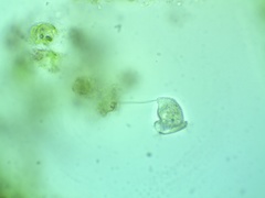 Vorticella