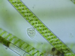 Vorticella