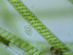 Vorticella