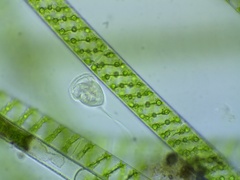 Vorticella