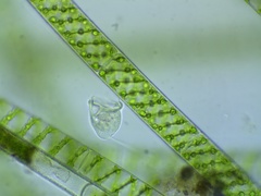 Vorticella