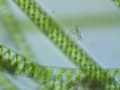 Vorticella